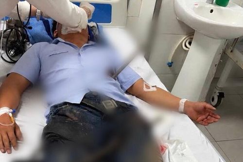 Cứu sống bệnh nhân bị hai thanh sắt xuyên qua người
