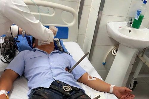 Báo động đỏ nội viện cứu sống bệnh nhân bị hai thanh sắt xuyên thấu cơ thể