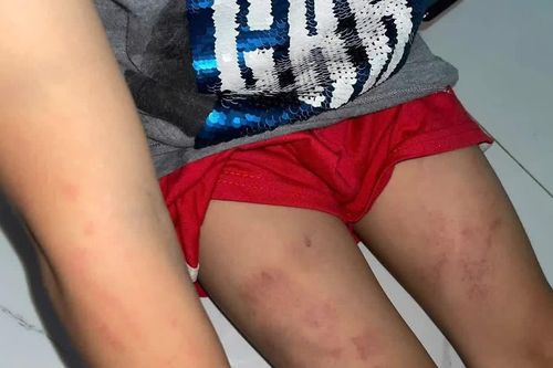 TIN NHANH: Tạm đình chỉ điểm giữ trẻ chui đánh bé trai 7 tuổi bầm tím ở Khánh Hòa