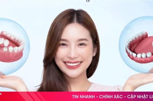 Nền tảng số giúp người tiêu dùng dễ dàng tiếp cận thông tin nha khoa