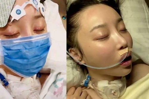 Từng bị ngừng tim hôn mê 3 tháng, nữ diễn viên hồi phục trở lại phim trường