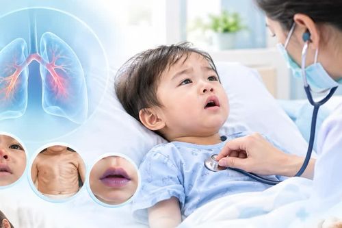 Bệnh hô hấp ở trẻ nhỏ có thể chuyển nặng nhanh: Khi nào cần đưa trẻ đi cấp cứu?