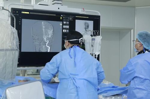 Đặt stent đổi hướng dòng chảy cứu người bệnh có túi phình động mạch cảnh chỗ gập góc