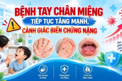 Bệnh tay chân miệng tiếp tục tăng mạnh, cảnh giác biến chứng nặng