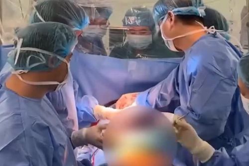 Cấy ghép tim nhân tạo bán phần cho bệnh nhân chờ ghép tim