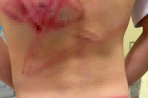 Lý do không khởi tố hình sự người cha đánh con trai 9 tuổi ở Quảng Trị