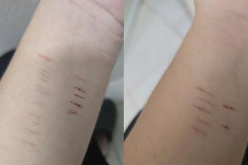 Trẻ có biểu hiện tự hại, cha mẹ phải làm gì?