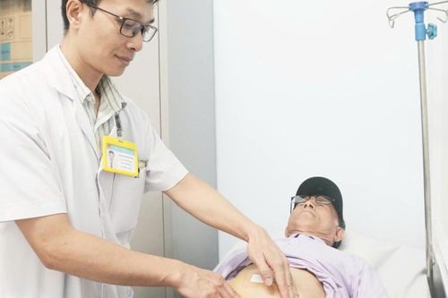 Đau bụng âm ỉ, cụ ông 82 tuổi phát hiện u nhầy ruột thừa hiếm gặp