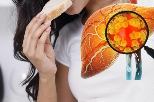 Cô gái phát hiện gan nhiễm mỡ độ ba vì thường xuyên ăn món này