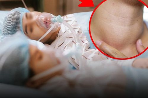 8 người một nhà cùng mắc một loại ung thư vì cổ to bất thường
