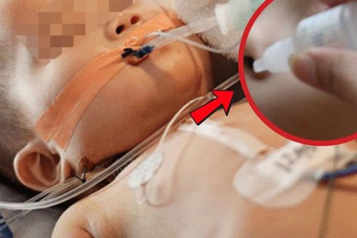 Bé gái 19 tháng tuổi cấp cứu ngưng thở vì ngộ độc thuốc nhỏ mũi