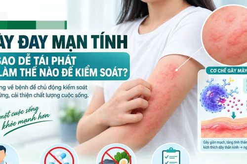 Mày đay kéo dài trên 6 tuần: Cẩn trọng tự chữa, kiêng khem quá mức