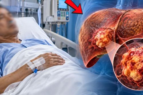 Ung thư gan 'nhắm' đến ai, yếu tố nguy cơ cần đặc biệt lưu ý