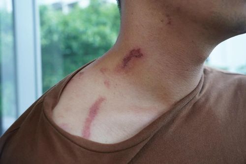 Kiến ba khoang vào mùa 'tấn công' sinh viên, tràn vào chung cư TP.HCM