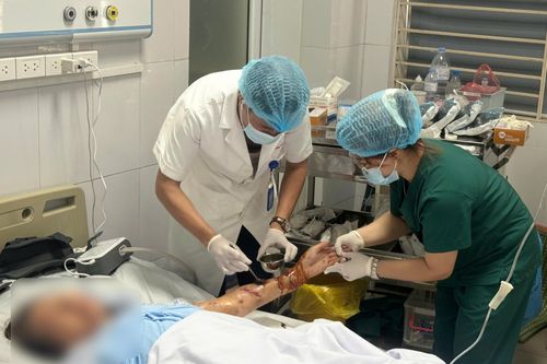 Hai người bị chó nhà tấn công với vết thương kinh hoàng