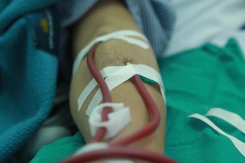 24 tuổi suy thận giai đoạn cuối, tiền tiết kiệm dành hết cho những buổi lọc máu