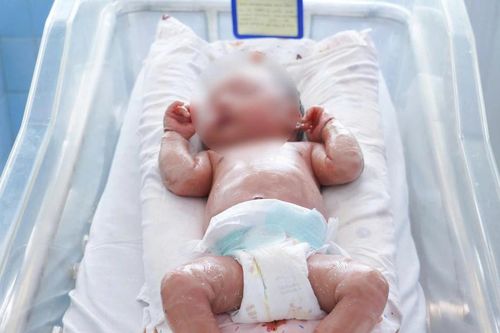 Bé sinh non mắc vảy cá hiếm gặp