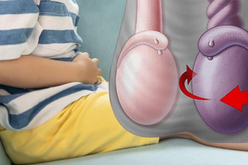 Đau bìu nhưng ngại không nói, cậu bé 14 tuổi suýt mất tinh hoàn