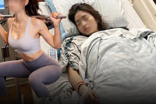 Cô gái 20 tuổi cấp cứu sau thử thách squat 300 lần trên mạng