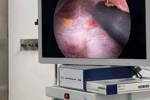 Phẫu thuật nội soi tuyến giáp – thêm lựa chọn cho bệnh nhân tại BV Bạch Mai cơ sở Ninh Bình