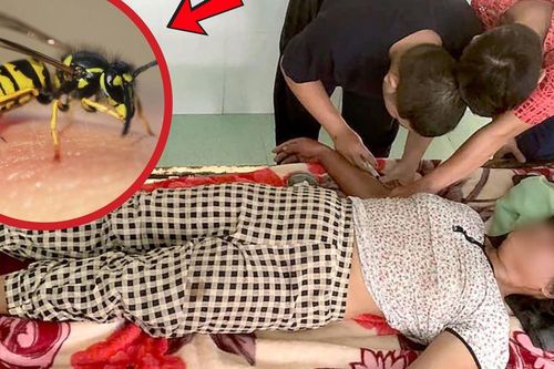 Người phụ nữ hôn mê vì ong vò vẽ đốt 20 nốt khi đi chăn bò