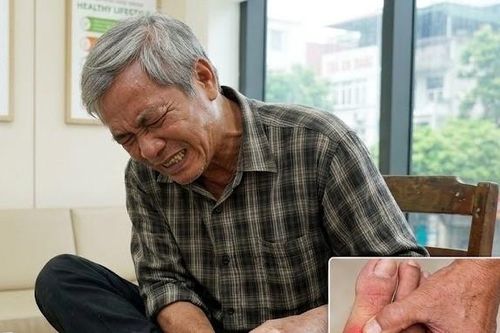 Kiêng khem đủ thứ, vì sao người mắc bệnh gout vẫn đau?