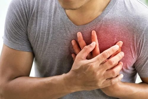Vì sao người trẻ phải can thiệp tim mạch ngày càng nhiều?