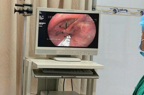 Người đàn ông 56 tuổi bị kiến chui vào thanh quản từ 1 việc không ngờ tới