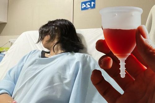 Cô gái 30 tuổi nhiễm trùng thận vì thứ 'đồ nữ giới' quen thuộc dùng hàng tháng