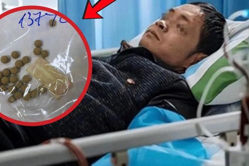 Người đàn ông suy gan vì tự uống thuốc chữa xơ gan, vàng da gấp 42 lần