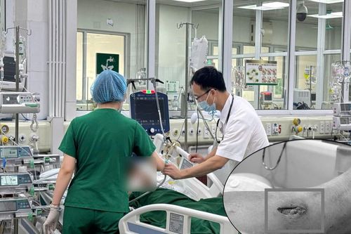 Tái phát uốn ván nguy kịch vì mảnh tre 3cm 'giấu mình' dưới vết thương đã lành