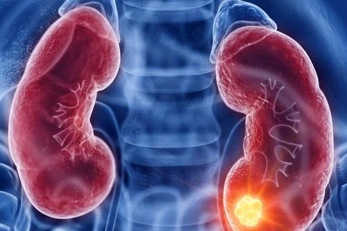 Chuyên gia cảnh báo nguy cơ suy thận nếu tiêu thụ quá nhiều loại dưỡng chất này