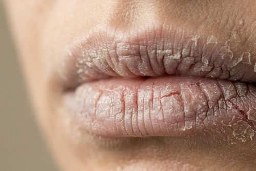 Lý do môi khô, da môi dễ bong vào mùa thu và cách khắc phục