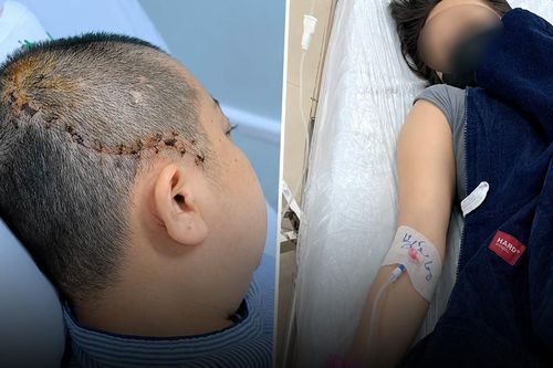 Đang ăn cơm cùng chồng, người phụ nữ đột ngột lịm đi, vỡ mạch máu não