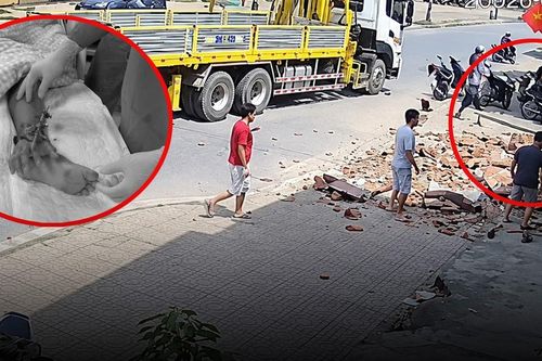 Cổng làng sập đè bé trai lớp 3, bác sĩ nối tạm bàn tay vào mạch máu cẳng chân