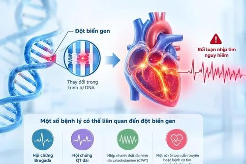 Ngất không rõ nguyên nhân, cảnh giác rối loạn nhịp tim do gene