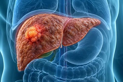 Giải pháp công nghệ mới trong chẩn đoán và điều trị bệnh gan mạn tính
