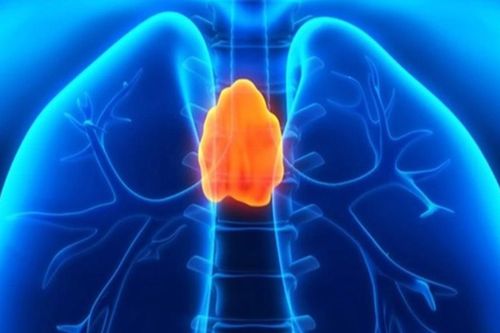 Người phụ nữ 49 tuổi phát hiện u tuyến ức ác tính từ dấu hiệu nhiều người bỏ qua