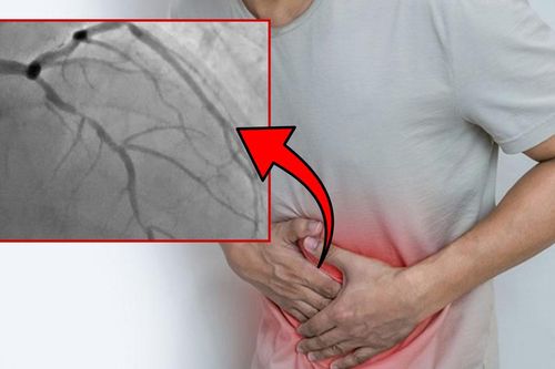 Đau thượng vị, người đàn ông phát hiện 3 nhánh mạch vành tổn thương nặng