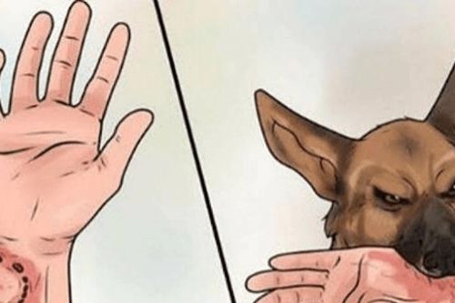 Bệnh dại: Bị chó mèo cắn, cần làm gì ngay?