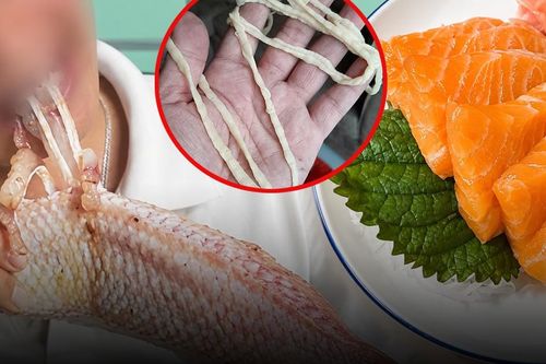Ăn cá sống nhiều năm, người đàn ông phát hiện 'sinh vật' dài 4,5m trong cơ thể