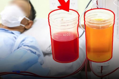 Tiểu ra máu đỏ như Coca, cụ ông tưởng viêm đường tiểu ai ngờ mắc ung thư