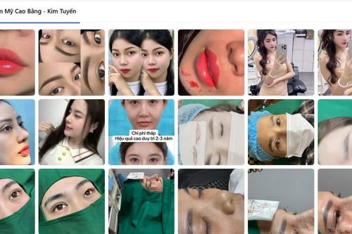 Khởi tố chủ spa thẩm mỹ lừa dối khách hàng, sử dụng hình ảnh giả mạo