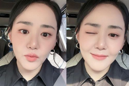 Nhan sắc 'em gái quốc dân' Moon Geun Young sau khi giảm cân