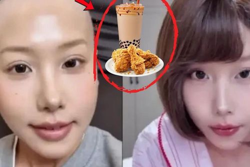 Mê món này nhiều năm, nữ blogger nổi tiếng qua đời ở tuổi 25 vì ung thư