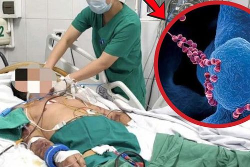 Người đàn ông 61 tuổi suy đa tạng, xuất huyết hoại tử vì thói quen phổ biến
