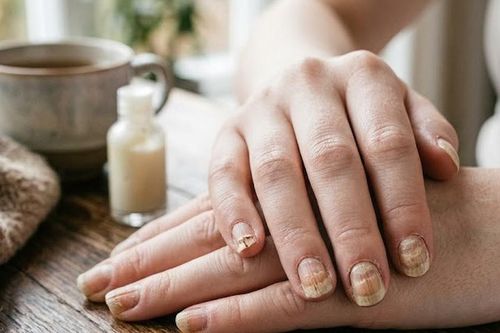 Móng mọc ngược gây đau xử trí thế nào?