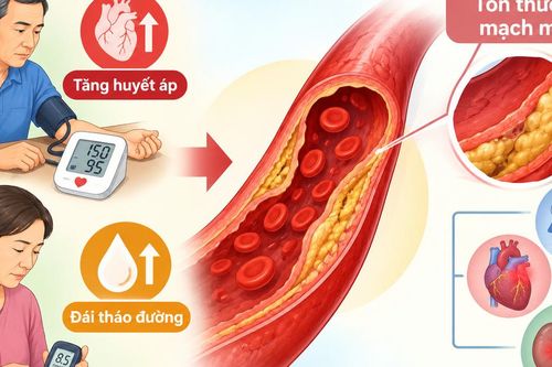 Phòng ngừa và kiểm soát tăng huyết áp khi mắc đái tháo đường