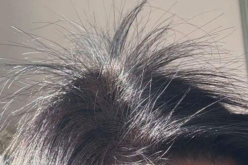 Mẹo nấu vỏ bưởi gội đầu kích tóc con mọc tua tủa