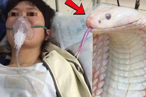 Bị rắn trắng cắn khi đang hái chè, nữ công nhân cấp cứu nguy kịch